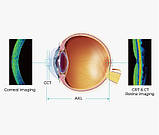 Біометр оптичний Colombo IOL Moptim Медапаратура, фото 4