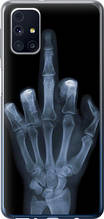 Чохол на Samsung Galaxy M31s M317F Рука через рентген "1007u-2055-851"