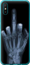 Чохол на Xiaomi Redmi 9A Рука через рентген "1007u-2034-851"
