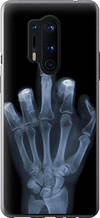 Чохол на OnePlus 8 Pro Рука через рентген "1007u-1896-851"