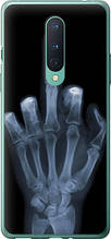 Чохол на OnePlus 8 Рука через рентген "1007u-1902-851"