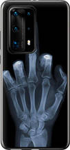 Чохол на Huawei P40 Pro Plus Рука через рентген "1007u-1917-851"
