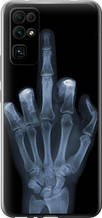 Чохол на Huawei Honor 30 Рука через рентген "1007u-1921-851"