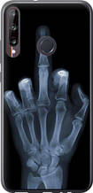 Чохол на Huawei P40 Lite E Рука через рентген "1007u-1875-851"