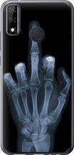 Чохол на Huawei Y8s Рука через рентген "1007u-2027-851"