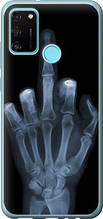 Чохол на Huawei Honor 9A Рука через рентген "1007u-1900-851"