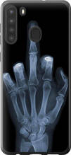 Чохол на Samsung Galaxy A21 Рука через рентген "1007u-1841-851"
