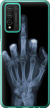 Чохол на Huawei Honor 10X Lite Рука через рентген "1007u-2198-851"