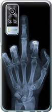 Чохол на Vivo Y51 2020 Рука через рентген "1007u-2241-851"