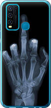 Чохол на Vivo Y30 Рука через рентген "1007u-2154-851"