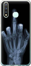 Чохол на Vivo Y19 Рука через рентген "1007u-630-851"