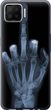 Чохол на Oppo A73 Рука через рентген "1007u-1379-851"