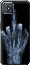 Чохол на Oppo Reno 4 Z Рука через рентген "1007u-2278-851"