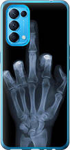 Чохол на Oppo Reno5 Рука через рентген "1007u-2206-851"