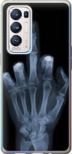 Чохол на Oppo Reno5 Pro Plus Рука через рентген "1007u-2243-851"