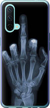 Чохол на OnePlus Nord CE Рука через рентген "1007u-2382-851"