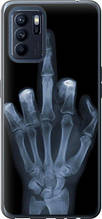 Чохол на Oppo Reno6 Z Рука через рентген "1007u-2477-851"