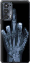 Чохол на Motorola Edge 20 Рука через рентген "1007u-2497-851"