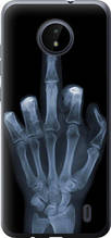Чохол на Nokia C20 Рука через рентген "1007u-2510-851"