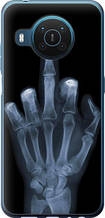 Чохол на Nokia X20 Рука через рентген "1007u-2532-851"