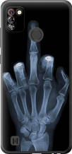 Чохол на Tecno Pop 4 Pro BC3 Рука через рентген "1007u-2444-851"