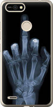 Чохол на Tecno Pop 2F B1F Рука через рентген "1007u-2391-851"