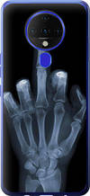 Чохол на Tecno Spark 6 KE7 Рука через рентген "1007u-2418-851"