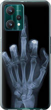 Чохол на Realme 9 Pro Рука через рентген "1007u-2595-851"