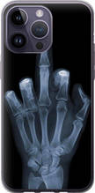 Чохол на iPhone 14 Pro Max Рука через рентген "1007u-2667-851"