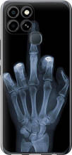 Чохол на Infinix Smart 6 Рука через рентген "1007u-2758-851"