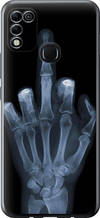 Чохол на Infinix Hot 11 Play Рука через рентген "1007u-2756-851"