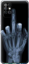 Чохол на Infinix Note 8 Рука через рентген "1007u-2710-851"