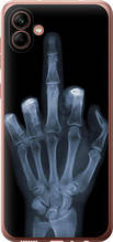 Чохол на Samsung Galaxy A04 A045F Рука через рентген "1007u-2831-851"