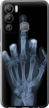 Чохол на Infinix Hot 12i Рука через рентген "1007u-2863-851"