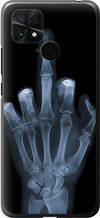 Чохол на Xiaomi Poco C40 Рука через рентген "1007u-2701-851"