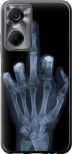 Чохол на Tecno POP 6 Pro BE8 Рука через рентген "1007u-2929-851"