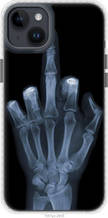Чохол на iPhone 14 Plus Рука через рентген "1007pm-2645-851"