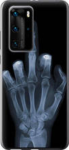 Чохол на Huawei P40 Pro Рука через рентген "1007u-1839-851"