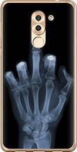 Чохол на Huawei GR5 2017 Рука через рентген "1007u-473-851"