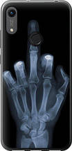 Чохол на Huawei Y6s Рука через рентген "1007u-1871-851"