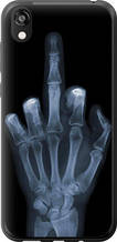 Чохол на Huawei Honor 8S Рука через рентген "1007u-1679-851"