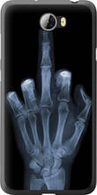 Чохол на Huawei Y5 II Рука через рентген "1007u-496-851"