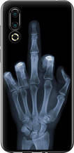 Чохол на Meizu 16S Рука через рентген "1007u-1701-851"