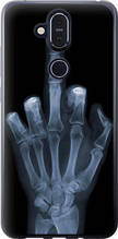 Чохол на Nokia 8.1 Рука через рентген "1007u-1620-851"