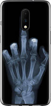 Чохол на OnePlus 7 Рука через рентген "1007u-1740-851"