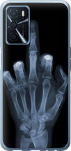 Чохол на Oppo A16 Рука через рентген "1007u-2469-851"