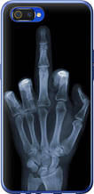 Чохол на Realme C2 Рука через рентген "1007u-1852-851"