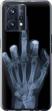 Чохол на Realme 9 Pro Plus Рука через рентген "1007u-2596-851"