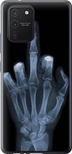 Чохол на Samsung Galaxy S10 Lite 2020 Рука через рентген "1007u-1851-851"