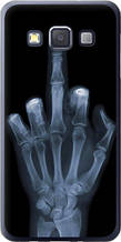 Чохол на Samsung Galaxy A3 A300H Рука через рентген "1007u-72-851"